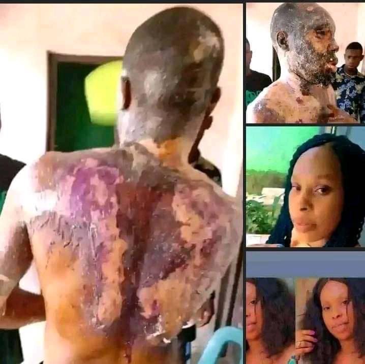 Police Arrest Woman For Pouring Hot Groundnut Oil On Her Husband